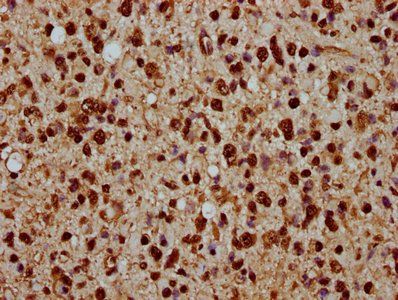 HIST1H1C (Ab-45) Antibody