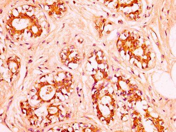 HIST1H1C Antibody