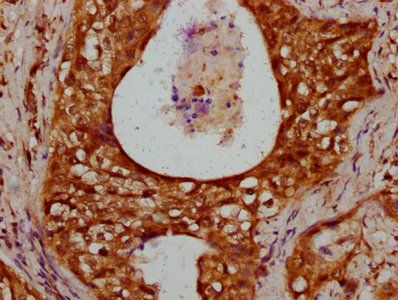 HIST1H1C Antibody