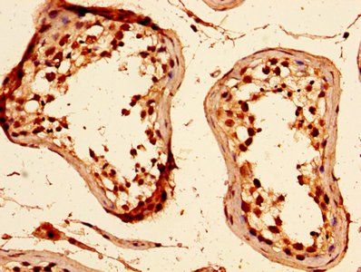 HIST1H1C Antibody