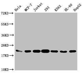 HIST1H1C (Ab-96) antibody