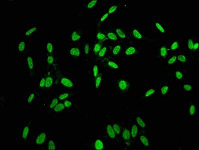 Phospho-HIST1H1C (T164) Antibody