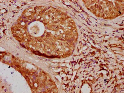 HIST1H1D Antibody