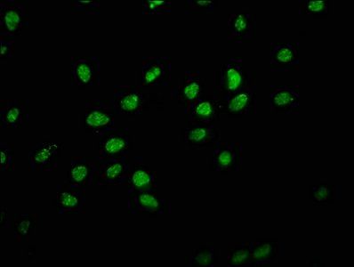 HIST1H1D (Ab-179) antibody