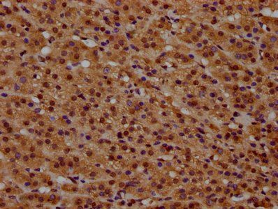 HIST1H1D Antibody