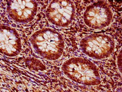 HIST1H1D Antibody