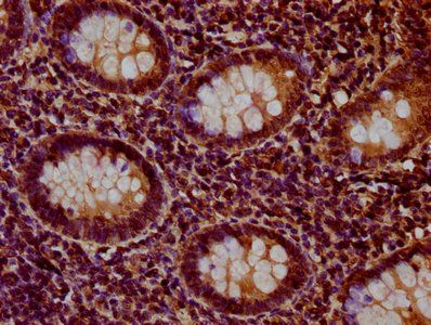 HIST1H1D Antibody