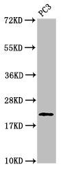 Phospho-HIST1H1D (T146) Antibody