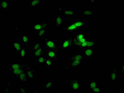 HIST1H1E Antibody