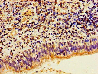 HIST1H1E Antibody