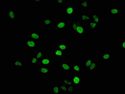 HIST1H1E Antibody