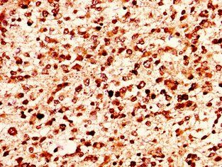 HIST1H1E Antibody