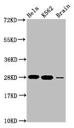 HIST1H1E (Ab-17) antibody