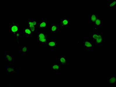 HIST1H1E (Ab-25) antibody