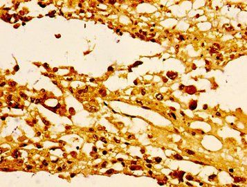 HIST1H1E (Ab-25) antibody