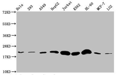 HIST1H1E (Ab-25) antibody