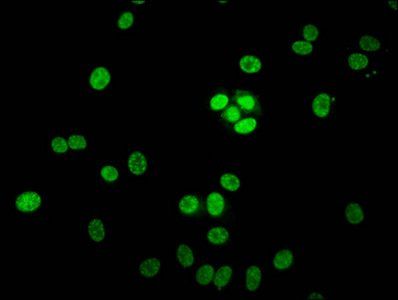 HIST1H1E (Ab-3) Antibody