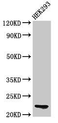 HIST1H1E (Ab-3) Antibody