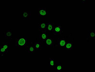 HIST1H1E Antibody