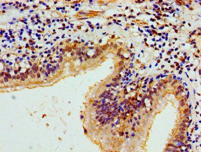 HIST1H1E Antibody