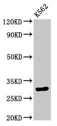 HIST1H1E Antibody
