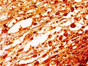 HIST1H1E Antibody