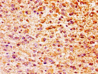 HIST1H1E Antibody