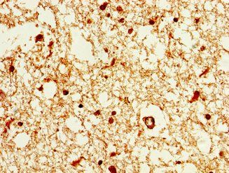 HIST1H1E Antibody