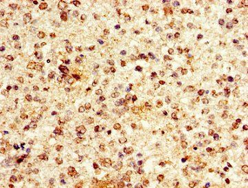 HIST1H1E Antibody