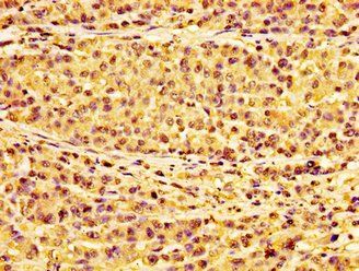HIST1H1E Antibody