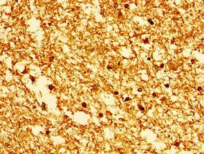 HIST1H1E Antibody