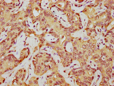 HIST1H1E Antibody