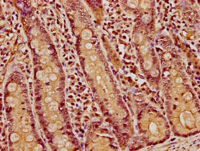 HIST1H1E Antibody