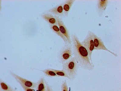 Phospho-HIST1H1E (S35) Antibody
