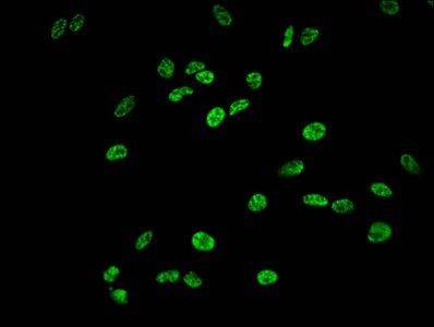 Phospho-HIST1H1E (S35) Antibody