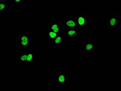 Phospho-HIST1H1E (T145) Antibody