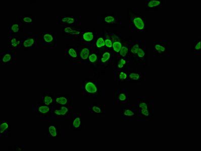 Phospho-HIST1H1E (T17) Antibody