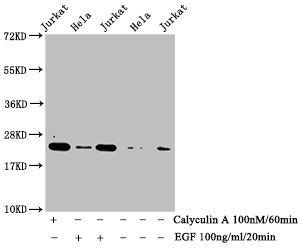 Phospho-HIST1H1E (T17) Antibody