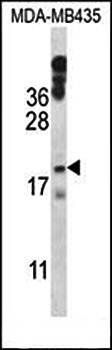 HIST1H1E antibody
