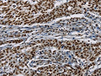 HIST1H2AB Antibody