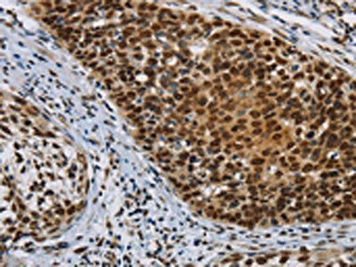 HIST1H2AB Antibody