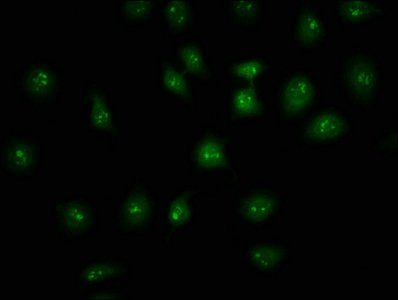 HIST1H2AC Antibody
