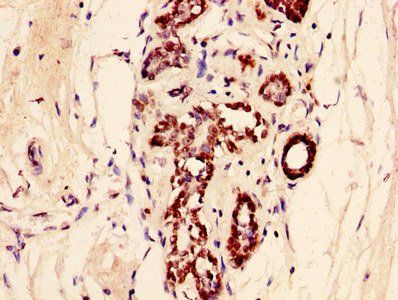 HIST1H2AG Antibody