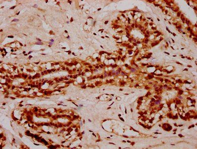 HIST1H2AG Antibody