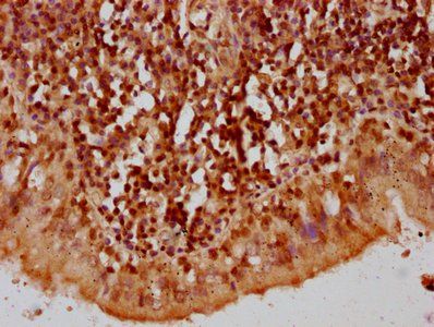 HIST1H2AG Antibody