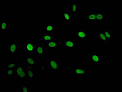 HIST1H2AG Antibody