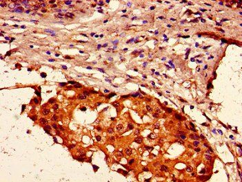 HIST1H2AG Antibody