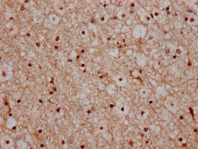 HIST1H2AG Antibody