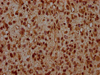 HIST1H2AG Antibody