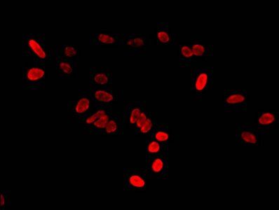 HIST1H2BB (Ab-16) antibody